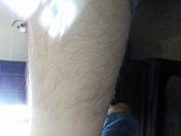 剃除体毛的影响和注意事项（了解剃除体毛的必要性和正确方式，避免不良后果）