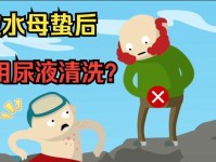 水母蛰伤的症状和处理方法（水母蛰伤对人体的影响及应急处理方法）